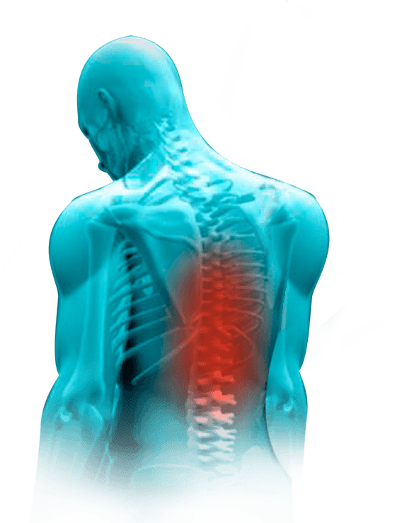 Dolor de espalda y muscular: visión general - Atención Primaria