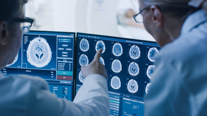 doctores revisando un escáner cerebral